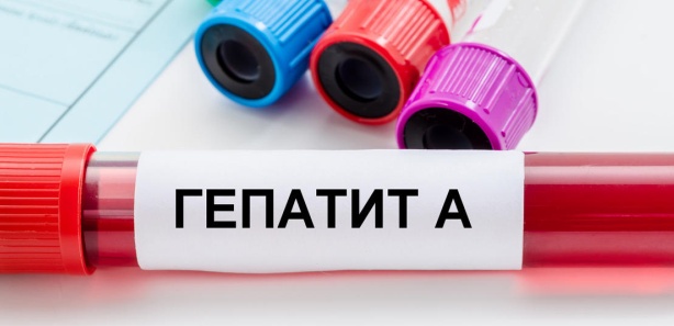 Hepatitis A