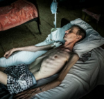 У виставочній експозиції зібрані фото реальних людей, які постраждали від туберкульозу.