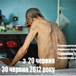 У Кіровограді покажуть справжнє обличчя хворих на туберкульоз