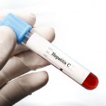 anti hcv analiz krovi