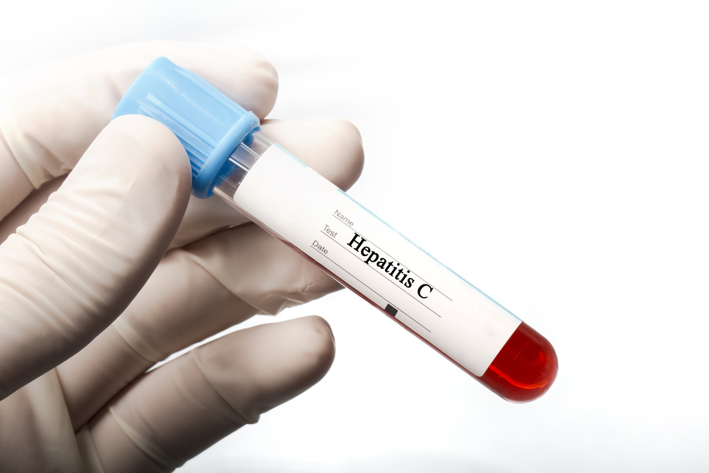 anti hcv analiz krovi